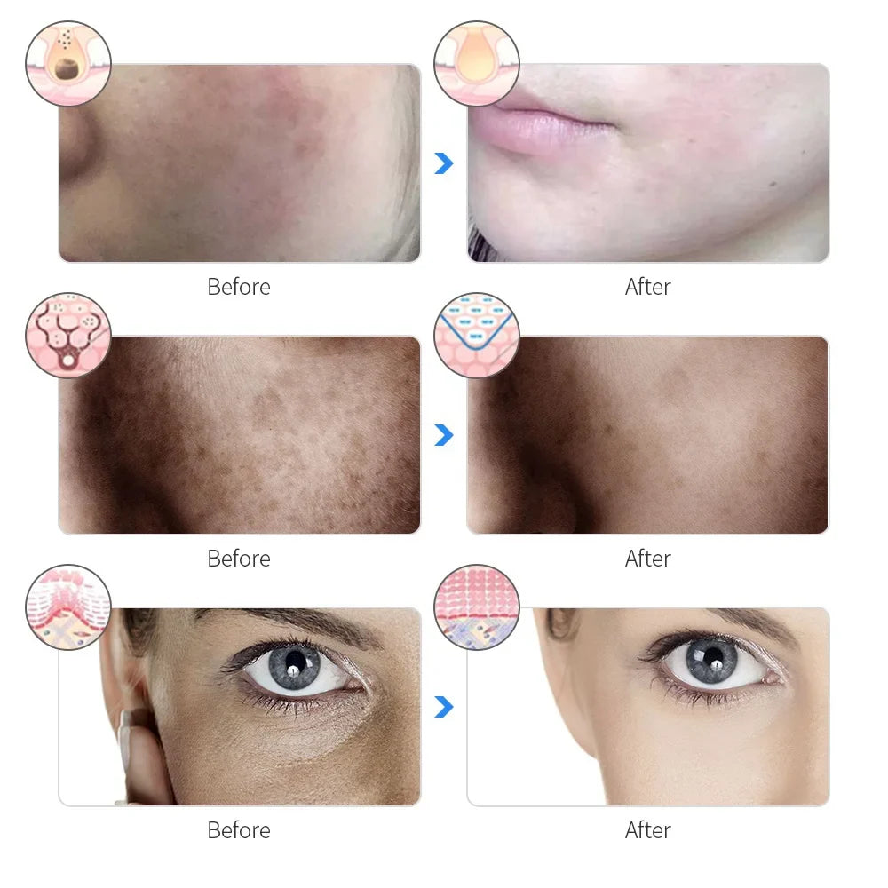 LED Facial Mask for Beauty Routine